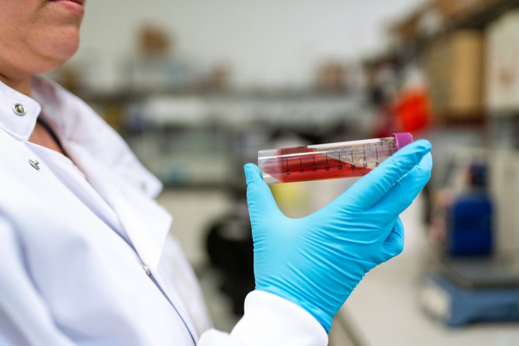 Lab assistant looking at sample